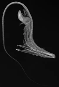 X-ray of a pelican-shaped largemouth X-ray of a pelican-shaped largemouth